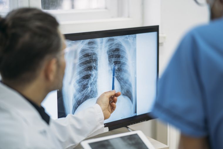 AI technology will assist doctors in identifying fractures on X-rays.